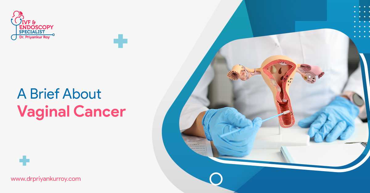 Gynae Onco Surgeon in Siliguri