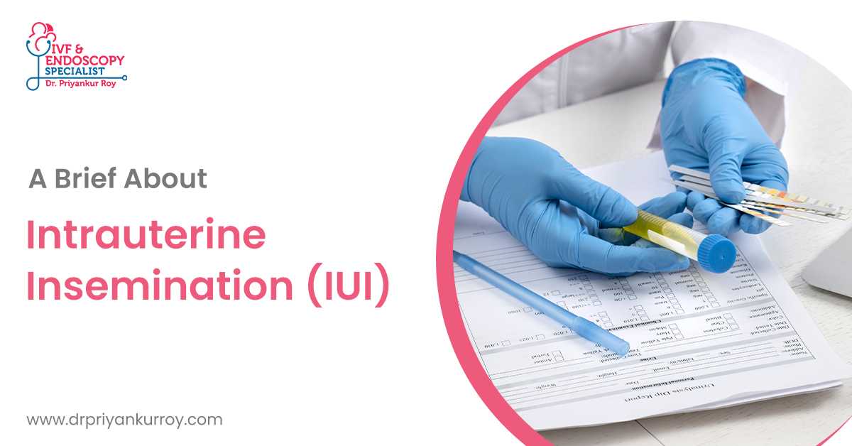 A Brief About Intrauterine Insemination (IUI)