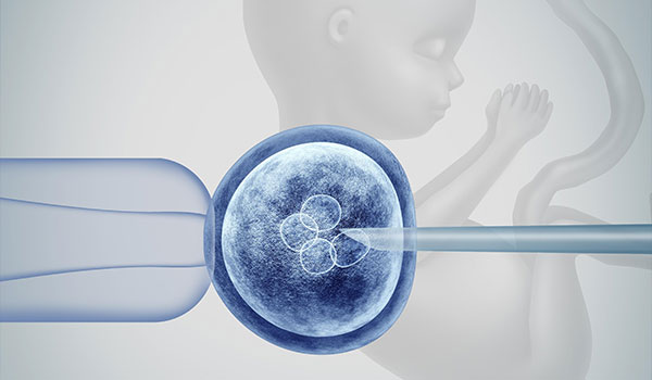 Intracytoplasmic Sperm Injection
