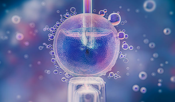 Intrauterine Insemination