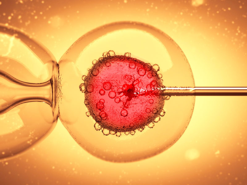 Intracytoplasmic Sperm Injection (ICSI)